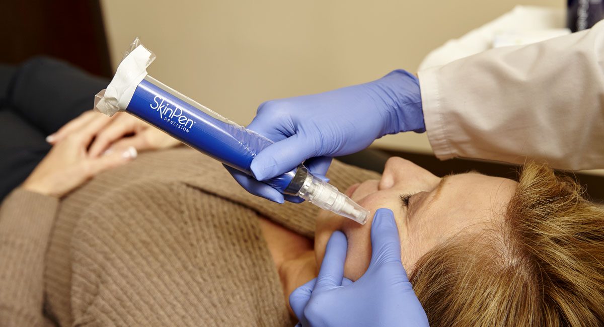 SkinPen Microneedling